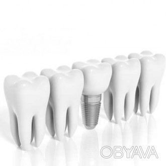 Имплантация зубов в Одессе
Современная стоматологическая клиника «Crealab. . фото 1