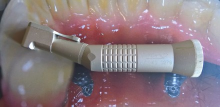 Продаются новые стоматологические наконечники, а так же сменные инструменты для . . фото 4