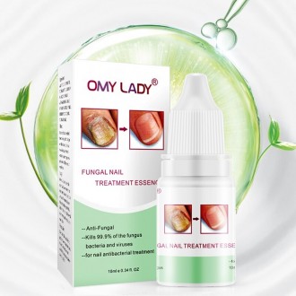 OMYLADY High Quality Nail Protector Skin Care ESSENCE Cream Крем для лечения гри. . фото 3