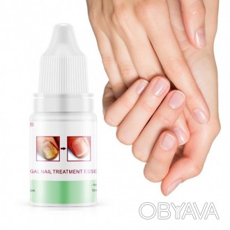 OMYLADY High Quality Nail Protector Skin Care ESSENCE Cream Крем для лечения гри. . фото 1